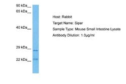 FAM220A Rabbit anti-Mouse, Polyclonal, Novus Biologicals 0.1ml; Unconjugated:Antibodies,